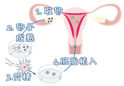 胚胎培養